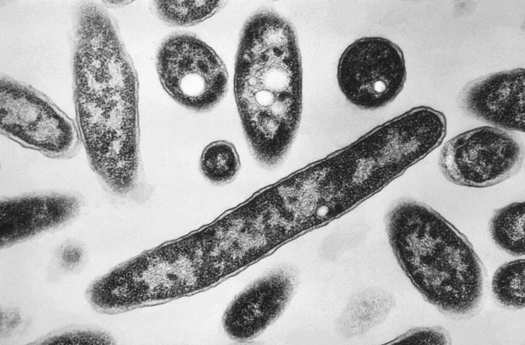 Legionnaire’s disease outbreak on Upper East Side claims its sixth victim